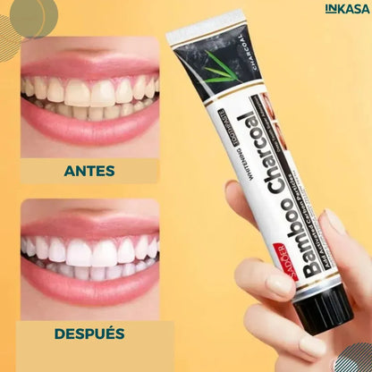Sonrisa blanca en minutos – Lumident™  PROMO 2x1
