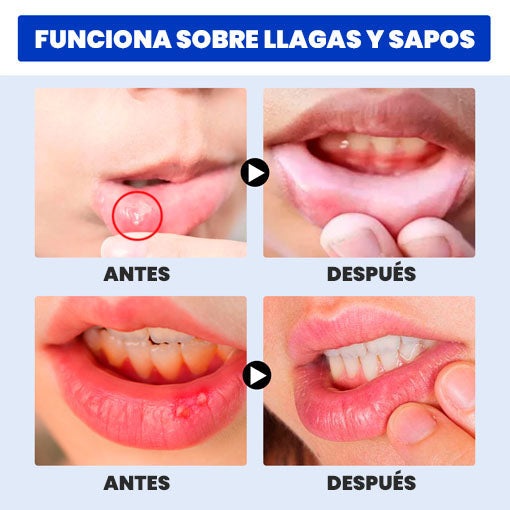 🎁PAGA 1 Y LLEVA 2🎁 Adiós dolor y sensibilidad - Dentisens